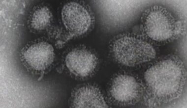 Doctors in Chicago warn about possible surge in flu cases as new strain spreads