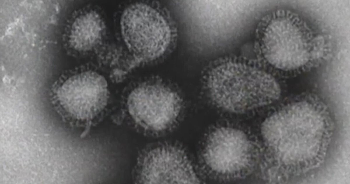 Doctors in Chicago warn about possible surge in flu cases as new strain spreads