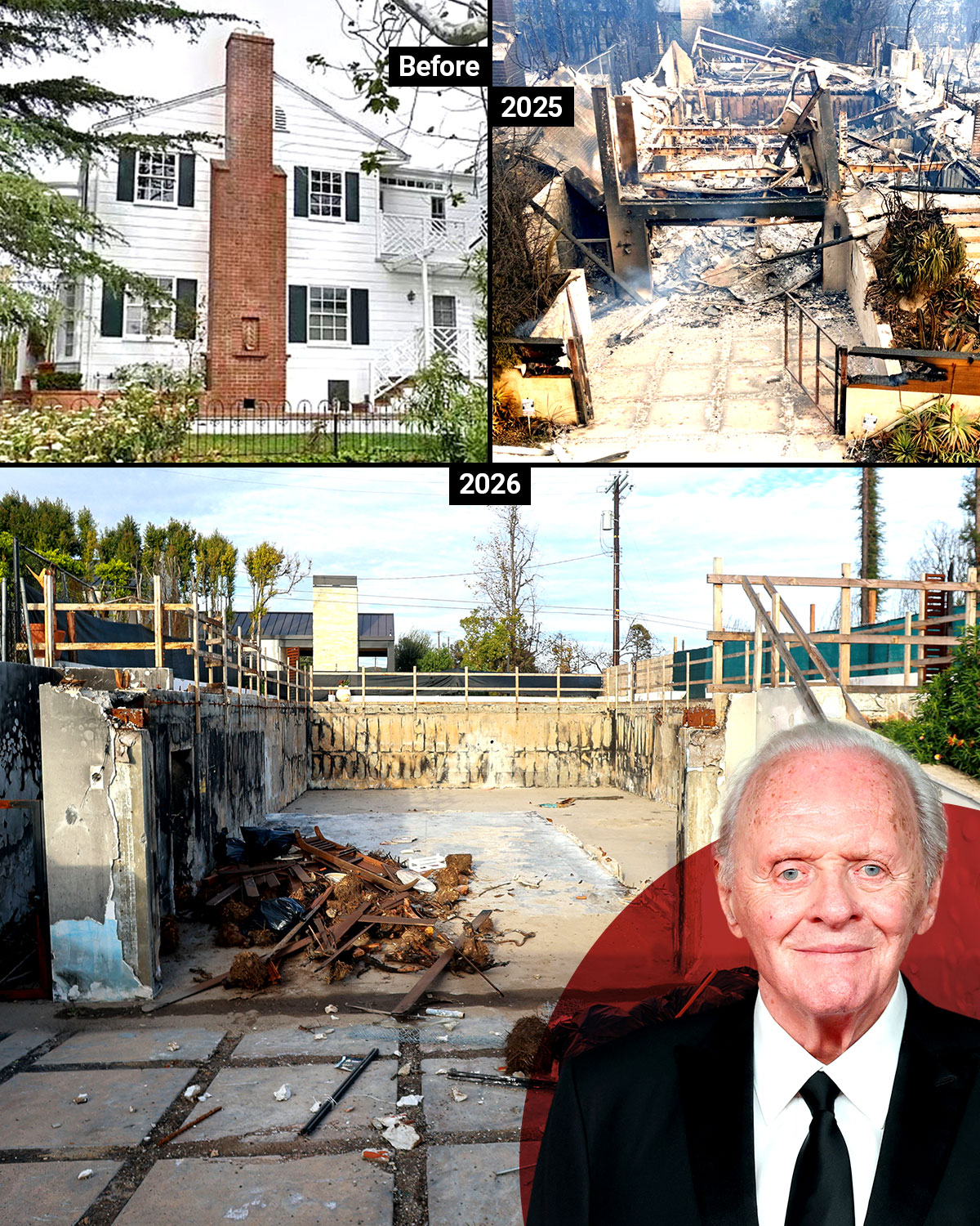 Collage of Anthony Hopkins and a house before, during, and after a fire.