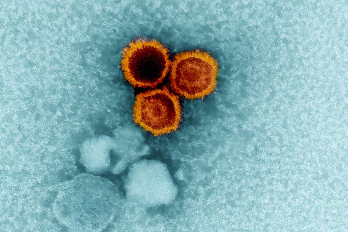 Scientists Link Epstein-Barr Virus to Higher Risk of Lupus and Stroke