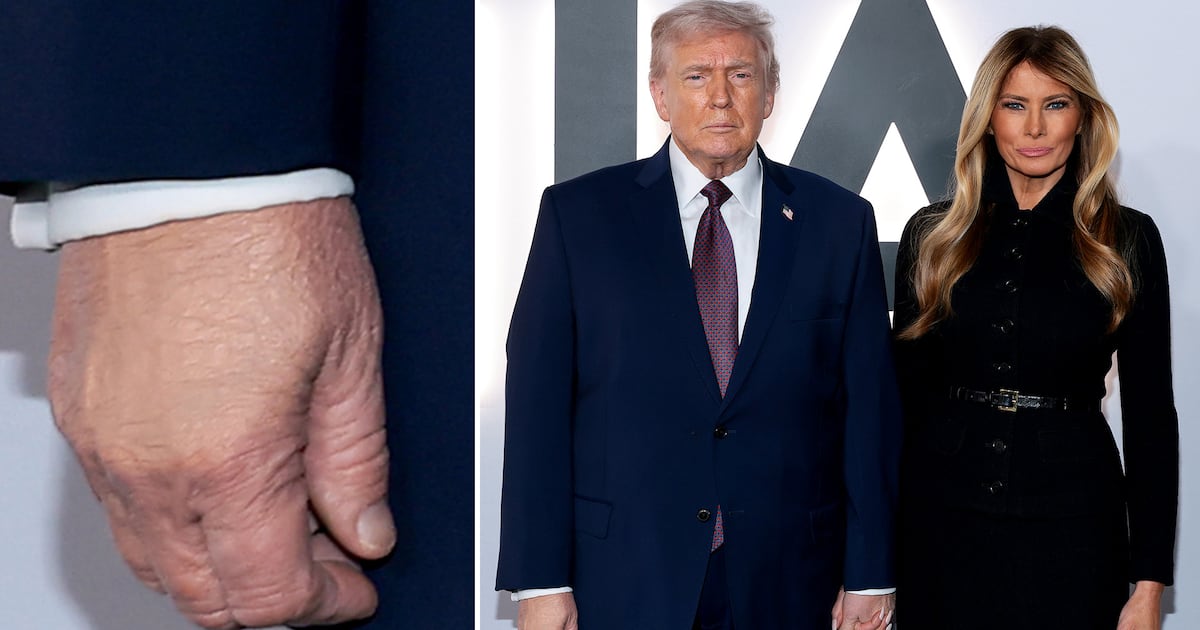Trump, 79, Coats Hand in Makeup for Melania’s Documentary Premiere