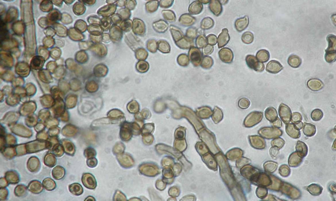 Chernobyl Black Fungus