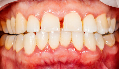 The State of Your Teeth Could Predict an Early Death, Study Shows : ScienceAlert