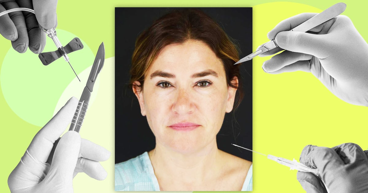 How This Woman in Her Late 40s Got Dramatic Results Without a Facelift