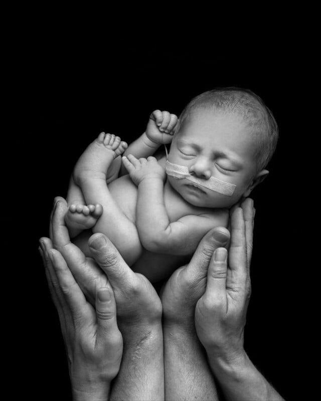 Black and white photo of a newborn baby with a nasal tube, peacefully sleeping and curled up in the gentle, supportive hands of two adults against a black background.