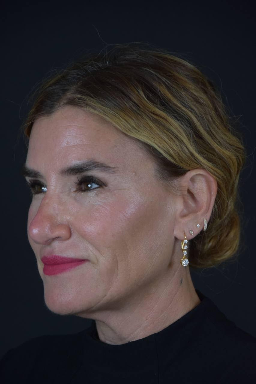 Dr. Sunder's patient Alli Webb