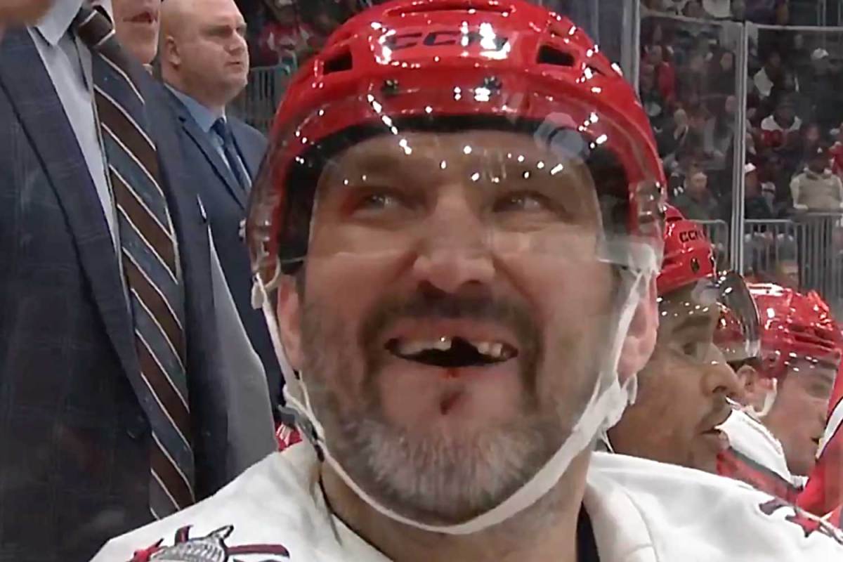 Alex Ovechkin gets tooth chipped after being high-sticked in face by Blackhawks’ Louis Crevier
