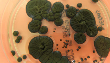 Chernobyl’s Radiation-Thriving Fungus Surprises Scientists