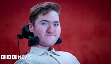 Jesy Nelson spoke about SMA this week