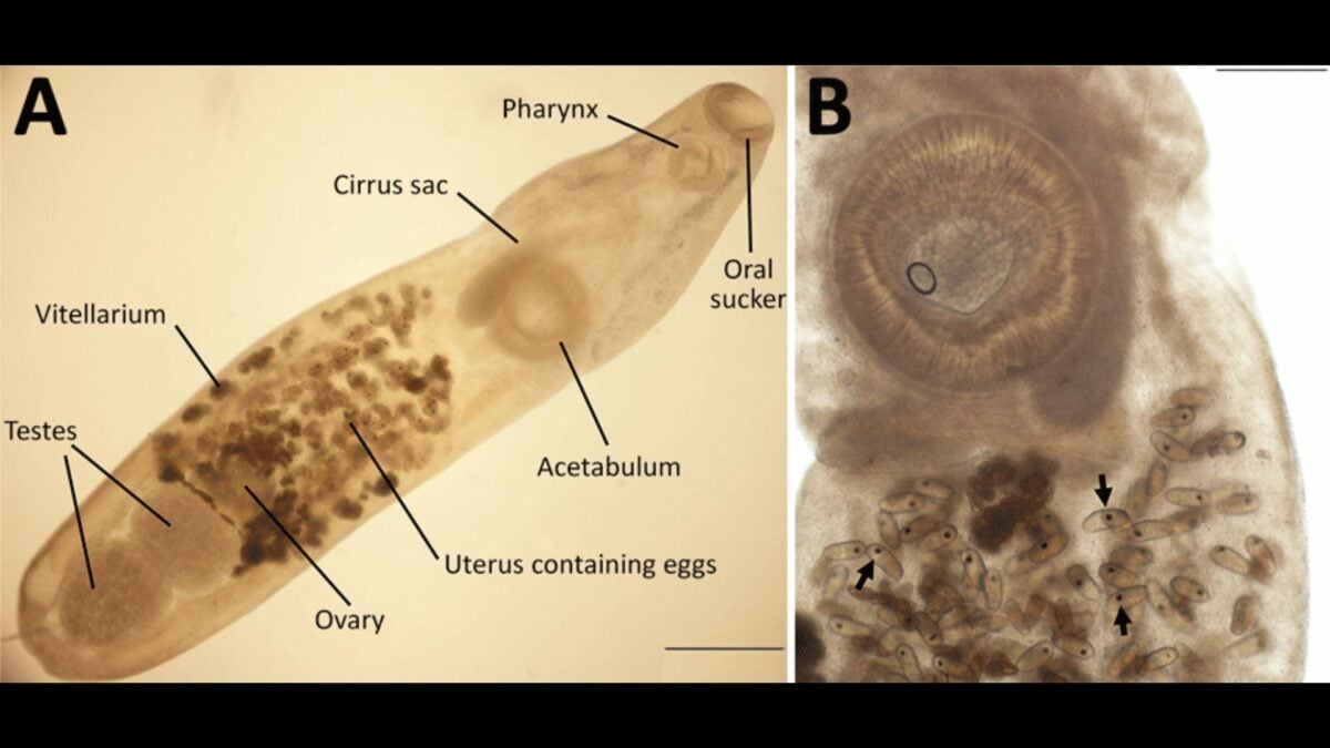 Woman Visits the Galápagos and All She Got Was This Exotic Eye Parasite