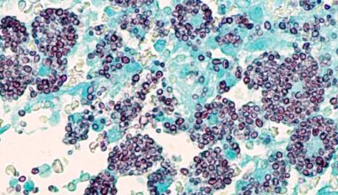 A Rare, Deadly Fungus Is Making People Sick in Tennessee