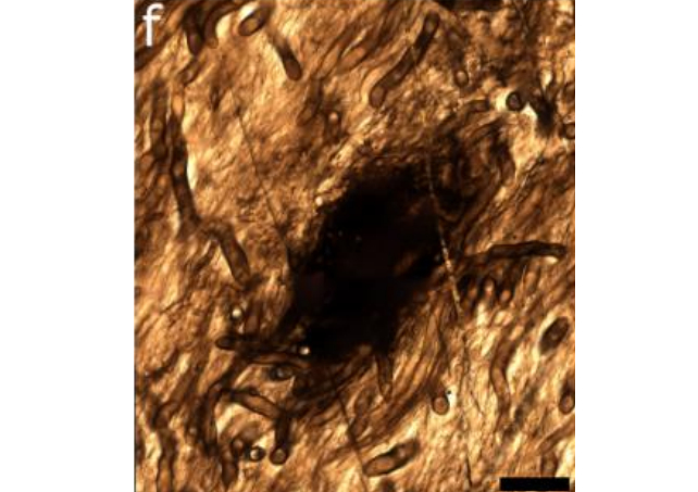 thin section of prototaxis fossil