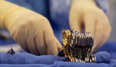 Government proposes new rules to reform organ transplant system