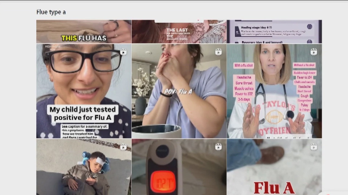 Flu cases surge in San Diego County as severe strain of influenza A spreads