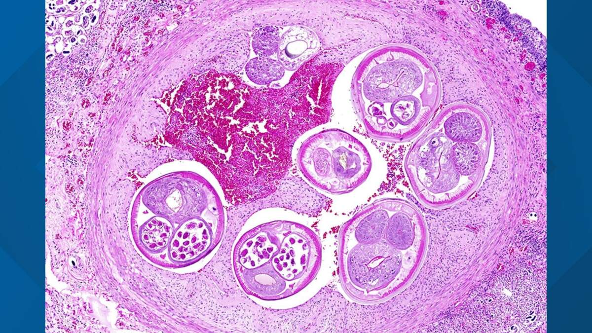 Brain Eating Worms Found In San Diego County | Newsradio 600 KOGO