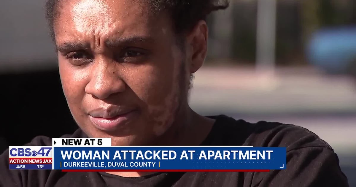 Jacksonville mother burned in grease attack says she now faces losing her home – Action News Jax