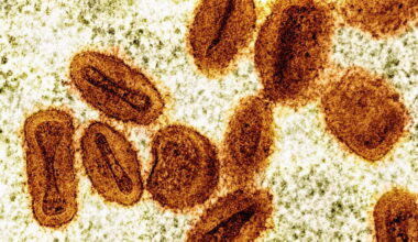 2 scientists charged with bringing deactivated mpox virus into US without permission