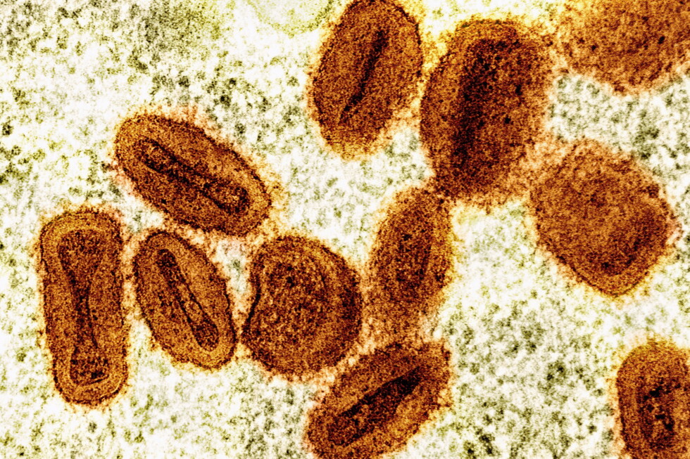 2 scientists charged with bringing deactivated mpox virus into US without permission