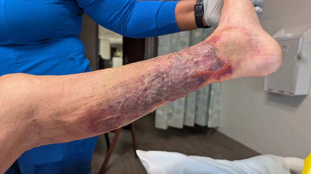 First flesh-eating bacteria death of 2026 recorded in this state