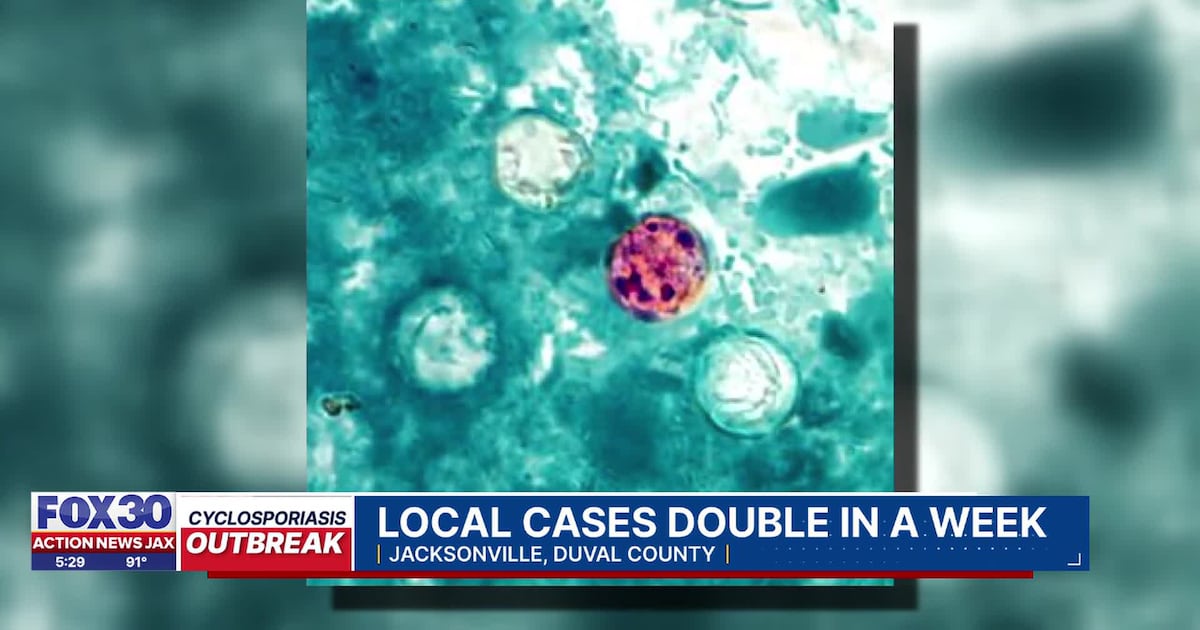 Cyclosporiasis cases rise to 96 across Florida