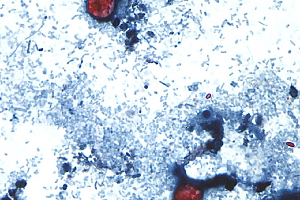 Taylor Farms expands lettuce recall to 27 states