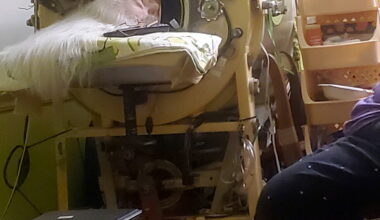 Martha Lillard, last US polio patient using iron lung, dies at 78