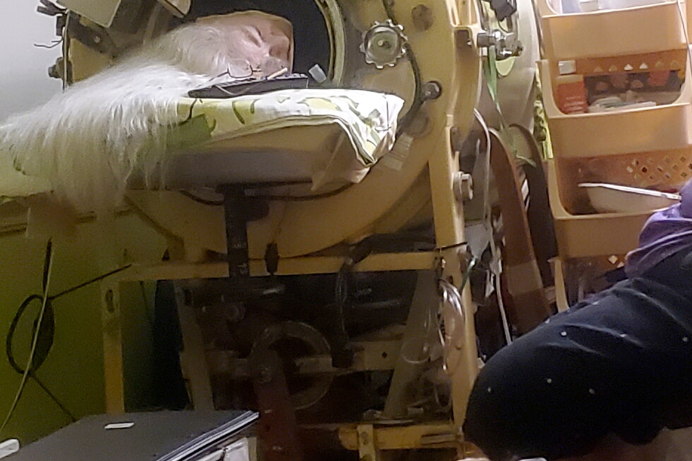 Martha Lillard, last US polio patient using iron lung, dies at 78