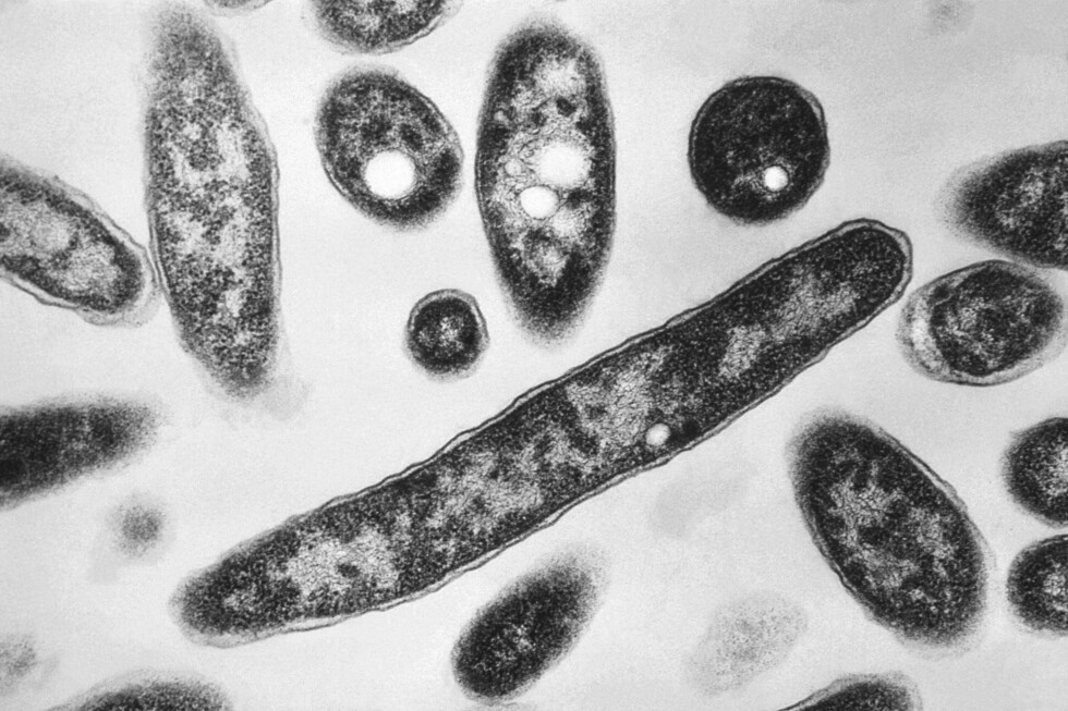 What to know about the Legionnaires' disease outbreak in NYC