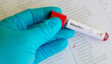 Measles outbreak linked to metro Atlanta daycare – WSB-TV Channel 2