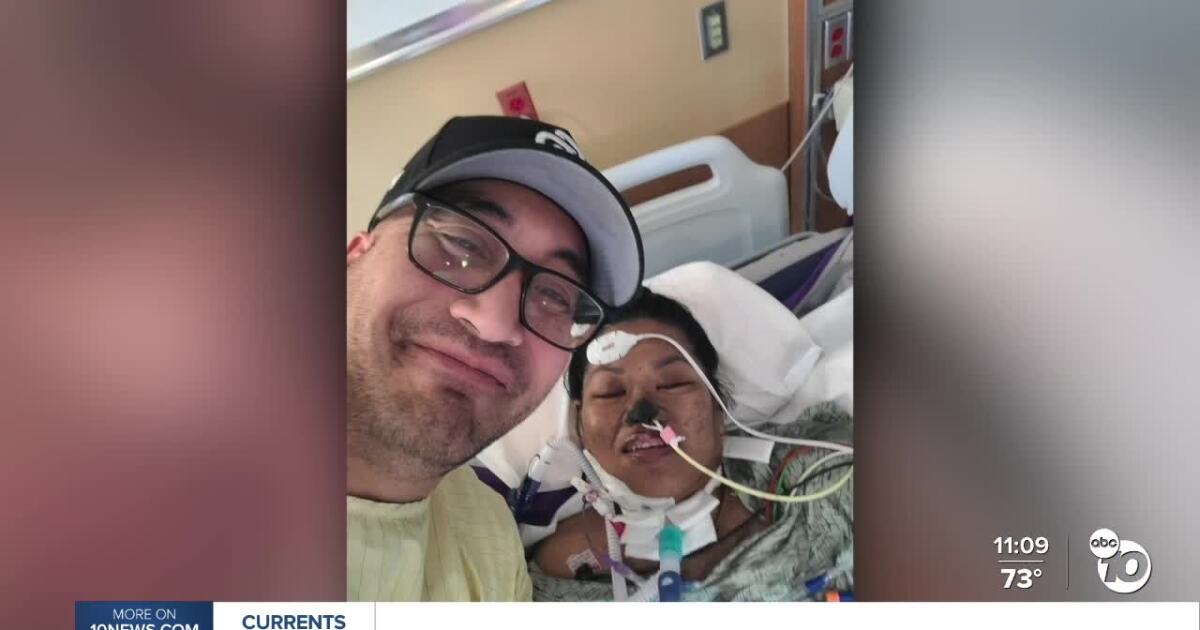 San Diego woman loses her arms and legs after surgery; husband seeks help