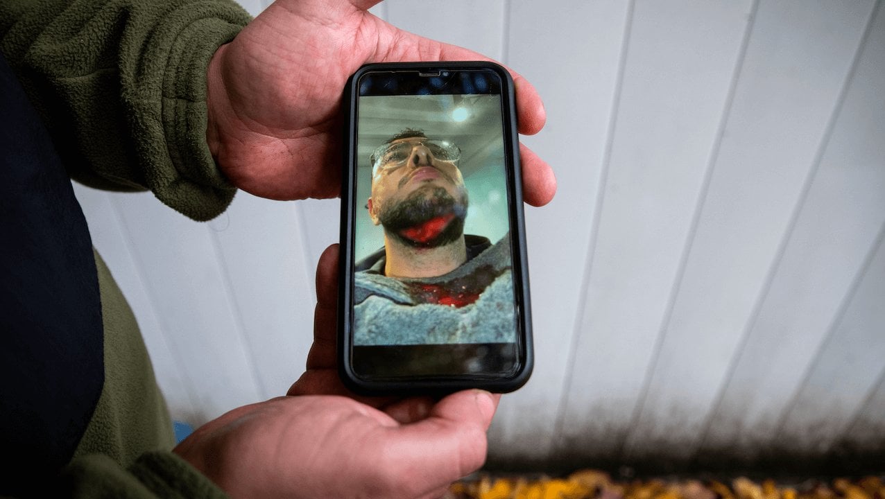 Tentative d'assassinat raciste il y a trois jours : personne n'en parle.