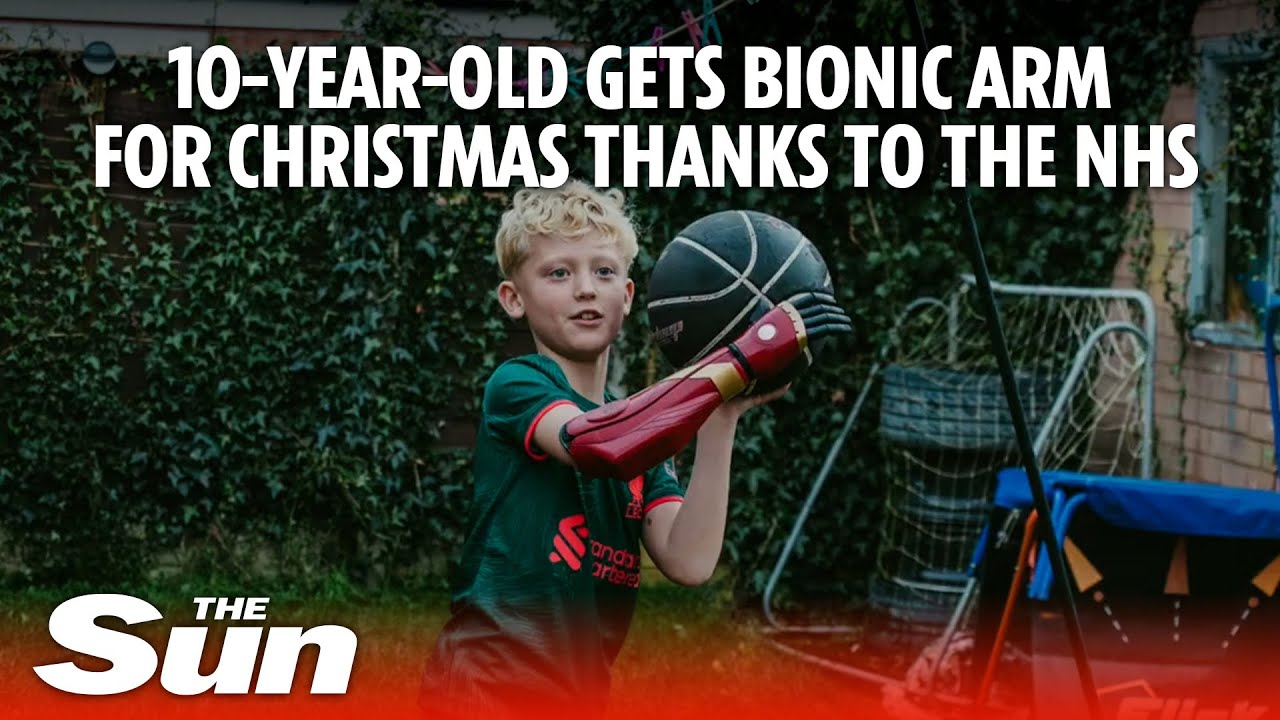 10-year-old receives 'Iron Man'-themed bionic arm for Christmas thanks to the NHS