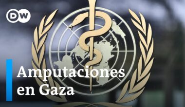 Las amputaciones se han convertido en algo habitual en Gaza, según la OMS