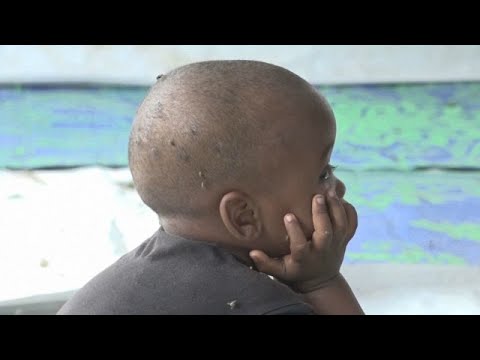 La ville de Port-Soudan confrontée à une épidémie de choléra