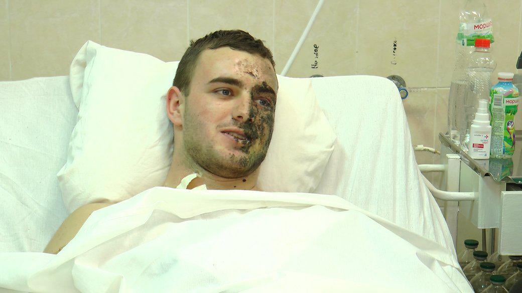 Nazar, a hero, worked as a locomotive engineer. After participating in the rescue of people from Kyiv, he made the courageous decision to join the army. Although he survived a drone attack, he suffered severe burns and lost an arm.