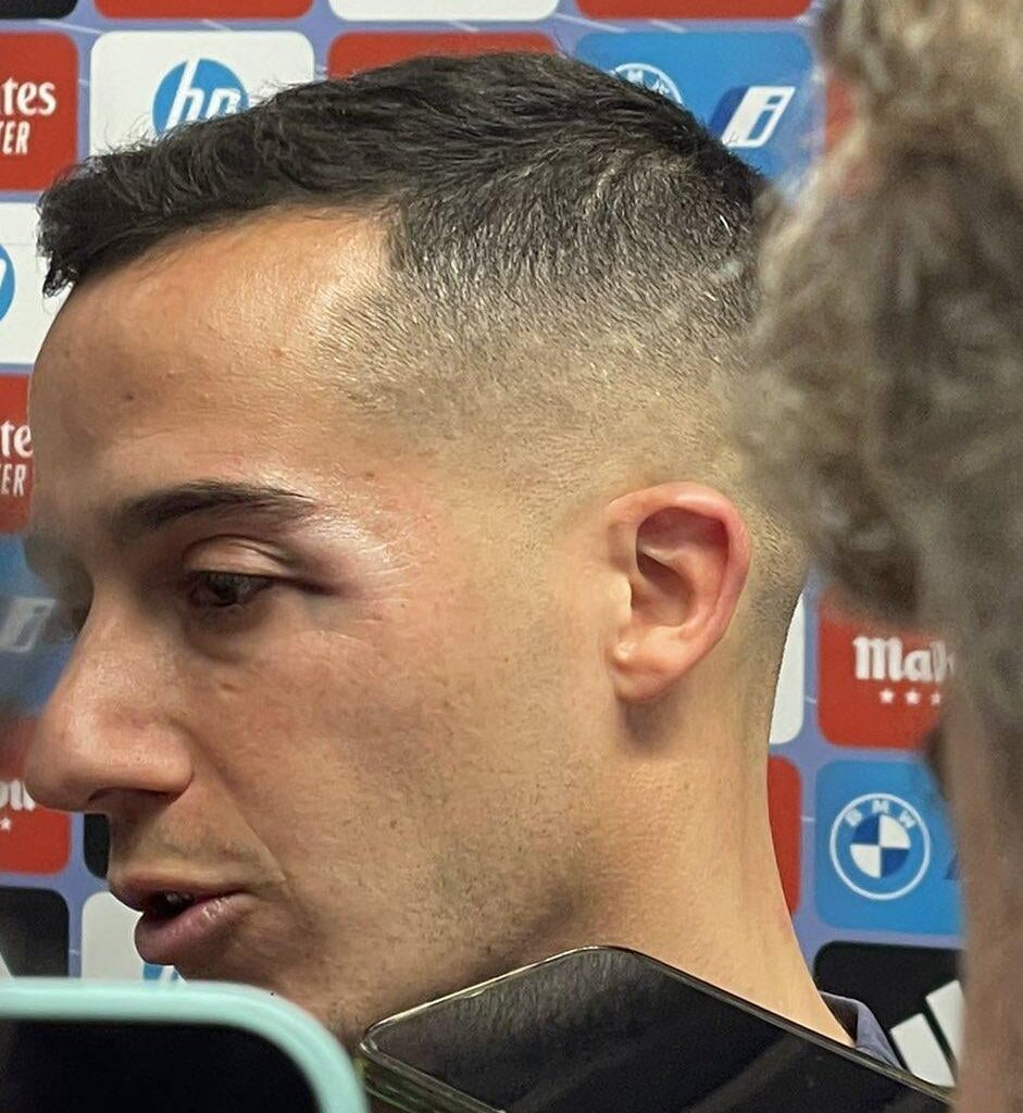 Lucas Vázquez's eye after being elbowed by Ocampos. No yellow card was given.