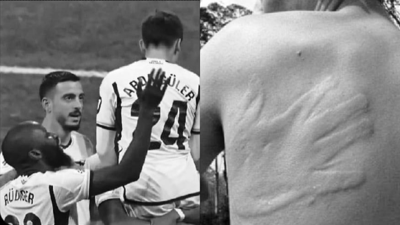 Arda back after that Rudiger slap