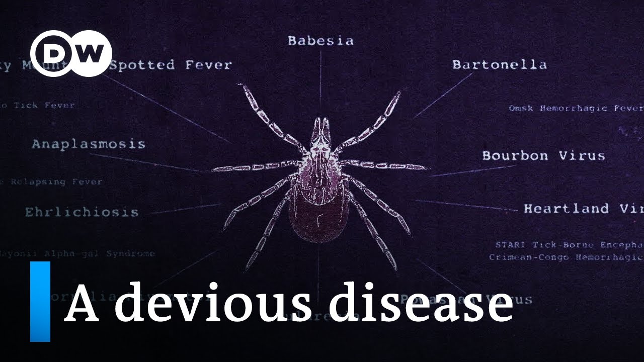 Lyme disease and the fight for recognition | DW Documentary