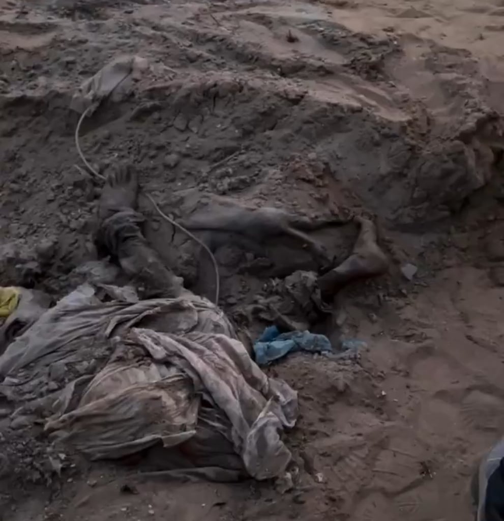 [NSFL] Pour cacher l'étendue du massacre de Al Shifa et rendre non-identifiable les victimes, l'armée Israëlienne a brûlé des familles entières, les ont enterré et passé au bulldozer. Ici on y voit des morceaux de cadavres d'enfants, des mains ligotées, dans les décombres