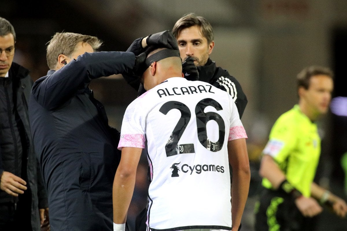 Alcaraz needed stitches for his head injury after the first half