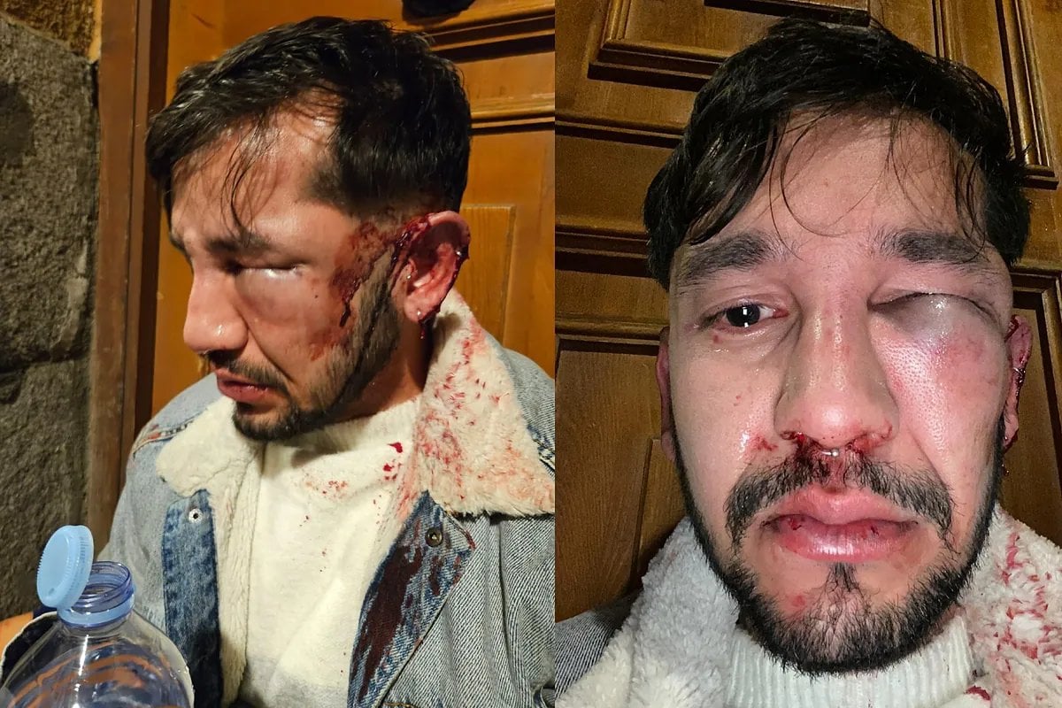 Agresión homófoba en el centro de Madrid: "Me guiñó un ojo y al acercarme, me dijo: 'Maricón de mierda, te voy a matar'"