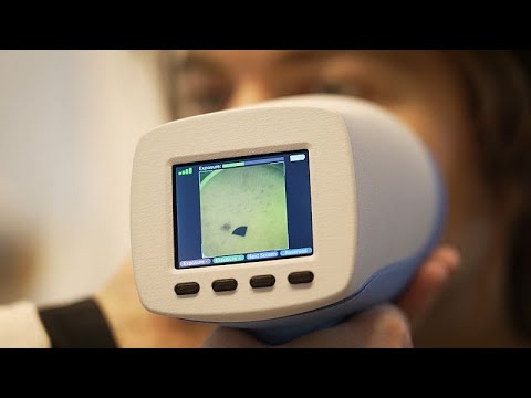Une nouvelle technologie pour détecter les cancers de la peau en 30 secondes
