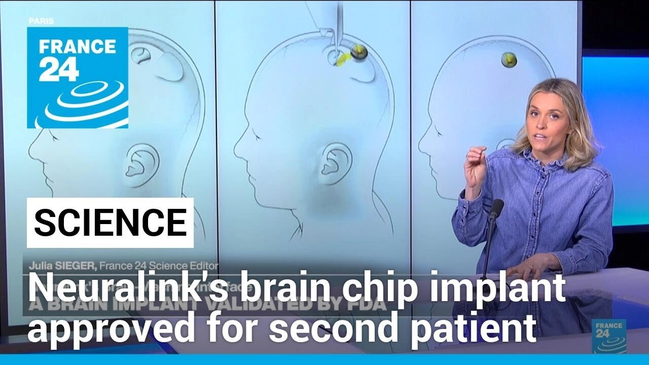 US FDA approves Neuralink's brain chip implant for second patient • FRANCE 24 English