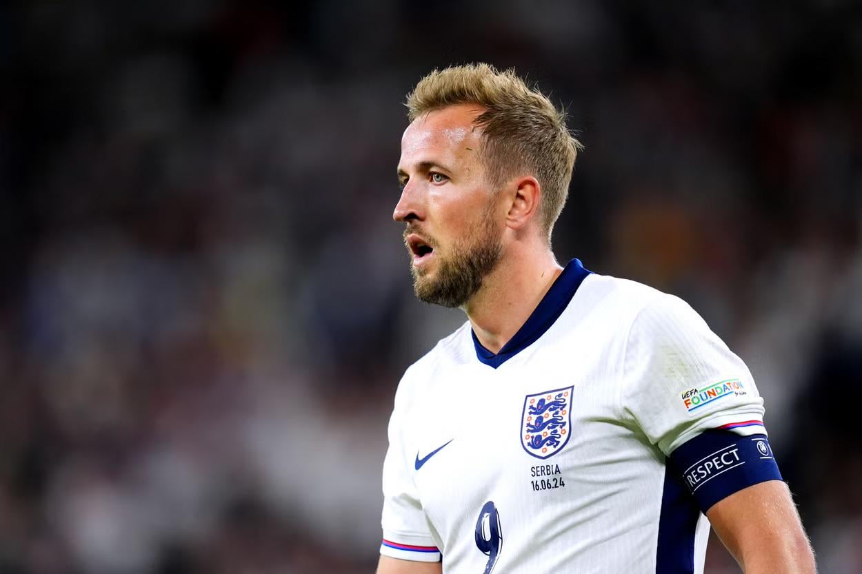 I love Harry Kane but why does he style his hair like it's the 00's