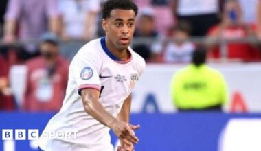 Bournemouth's Adams sidelined after back surgery