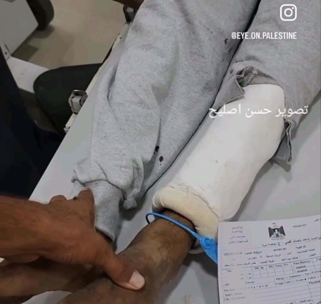 Aujourd'hui une douzaine de détenus palestiniens ont été libérés dont 2 femmes. 3 ont été emmenés en urgence à cause de leur état dû à la torture. L'un d'eux, traumatisé, a perdu la mémoire.