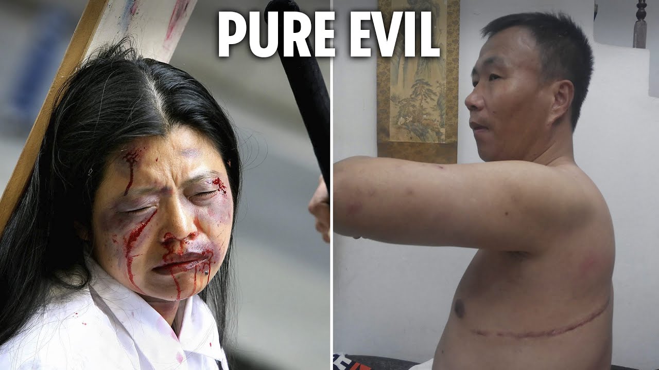 Horror of organ harvesting by China's 'Gestapo' revealed as first survivor shows injuries