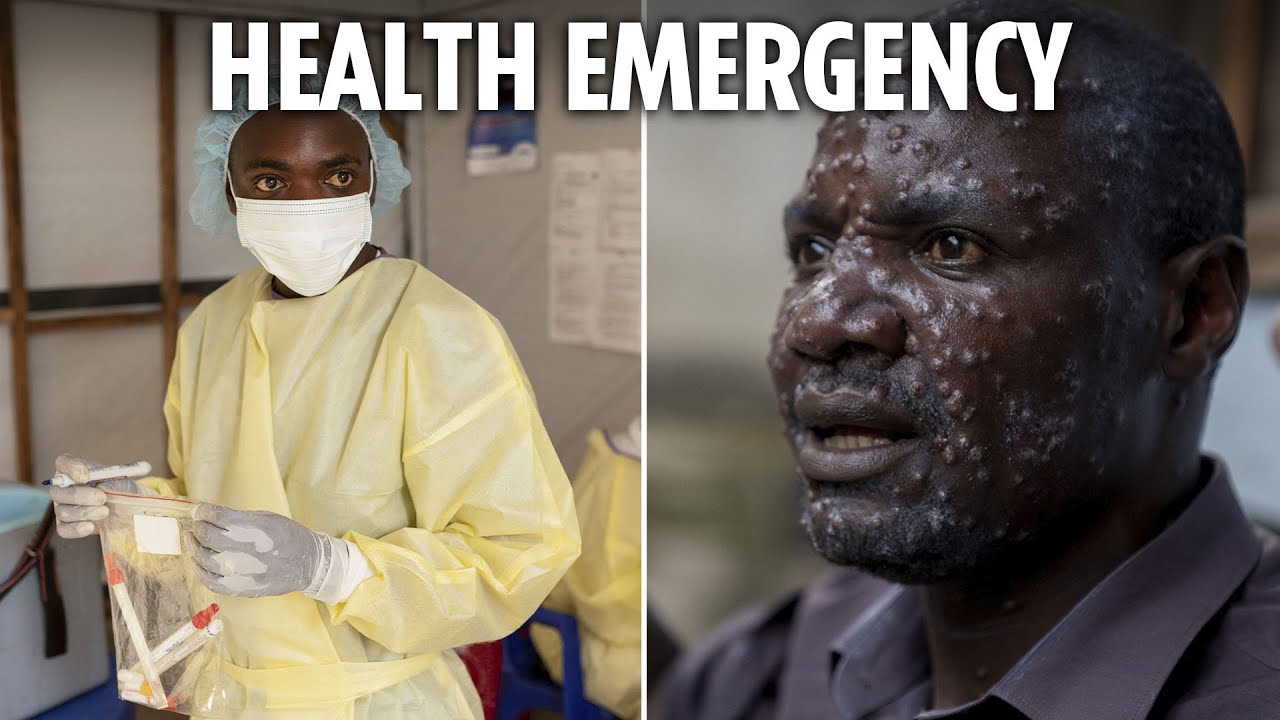Mutant Mpox strain declared global threat after spread across 13 countries - and Europe may be next