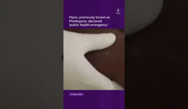 Mpox, previously known as Monkeypox,declared 'public health emergency'