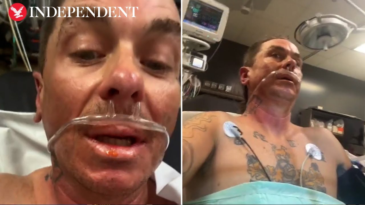 Slipknot's Sid Wilson shares video from hospital after 'explosion'